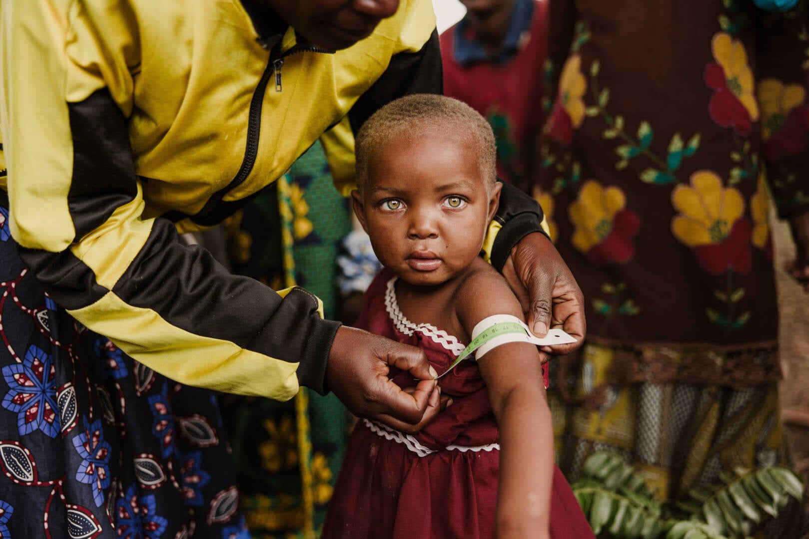 Portrait of a girl whose arm circumference is being measured.